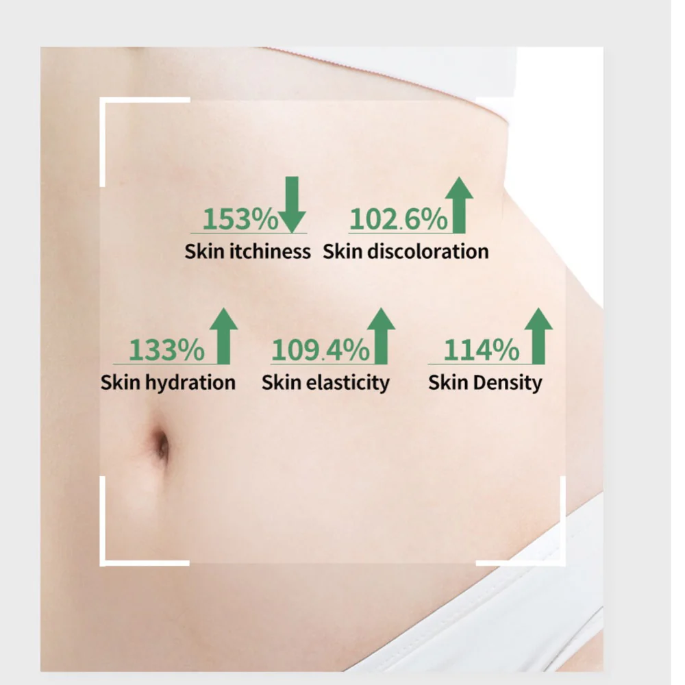Lalucell Anti-Stretch Mark Patch - Image 4