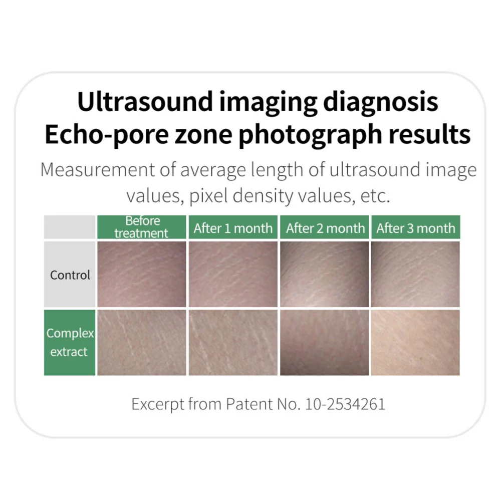 Lalucell Anti-Stretch Mark Patch - Image 8