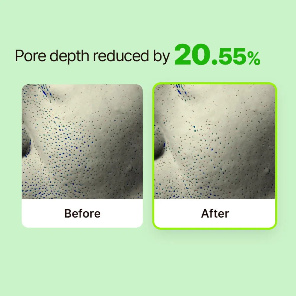 RETURNU Pore Shooter Gommage Cleansing Balm (95ml) - Image 7